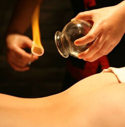 Sliding Cupping/Scraping（拔罐/刮痧）